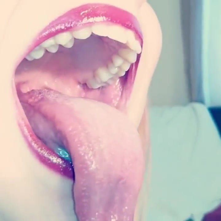 Showing uvula while braces