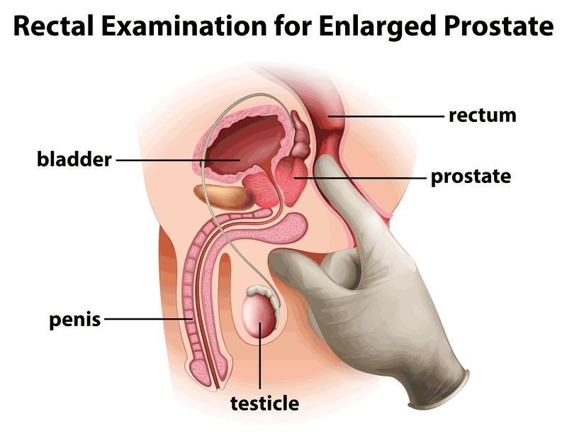 best of Penis exam guide testicles male genital