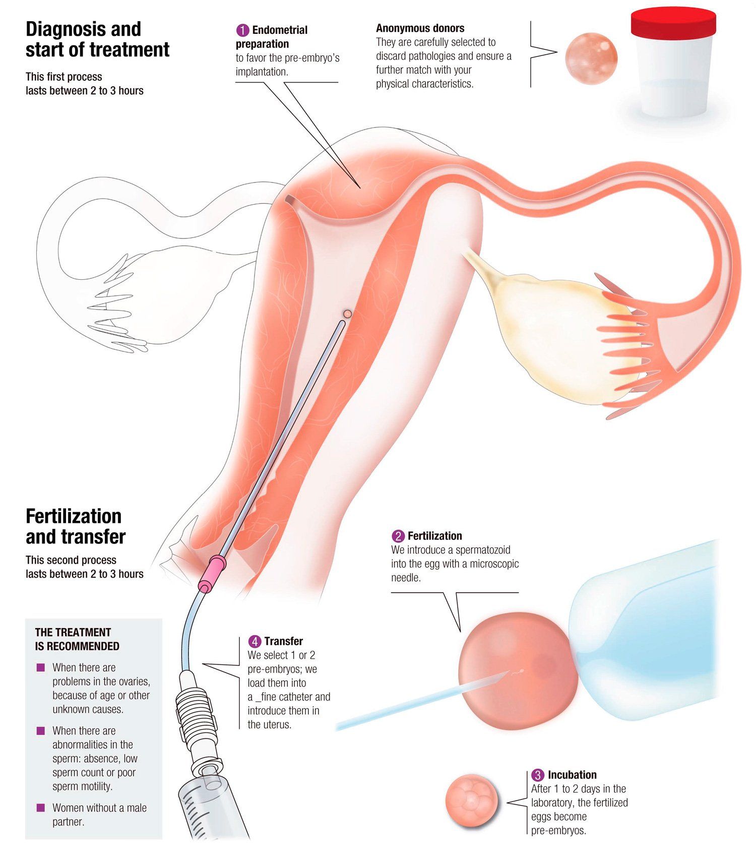 Whiskey reccomend cumming specimen sperm donation artificial insemination