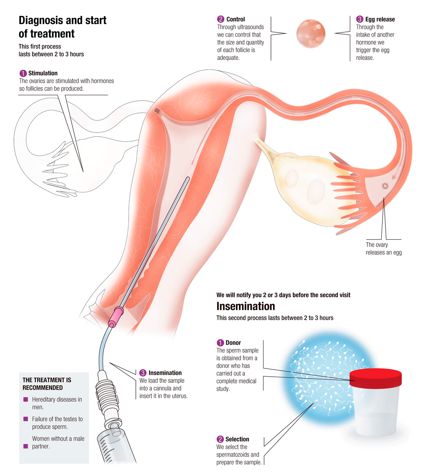 best of Artificial cumming specimen insemination donation sperm